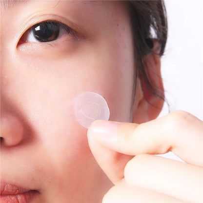 Microneedle patch applied on cheek